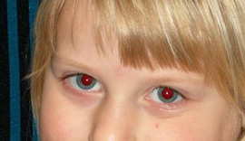 mt_popup:2 Les Yeux Rouges